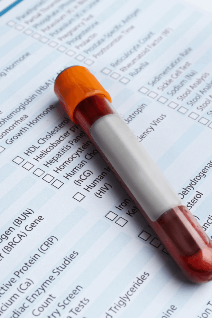 A testing vial laying on top of a blank lab test order form.